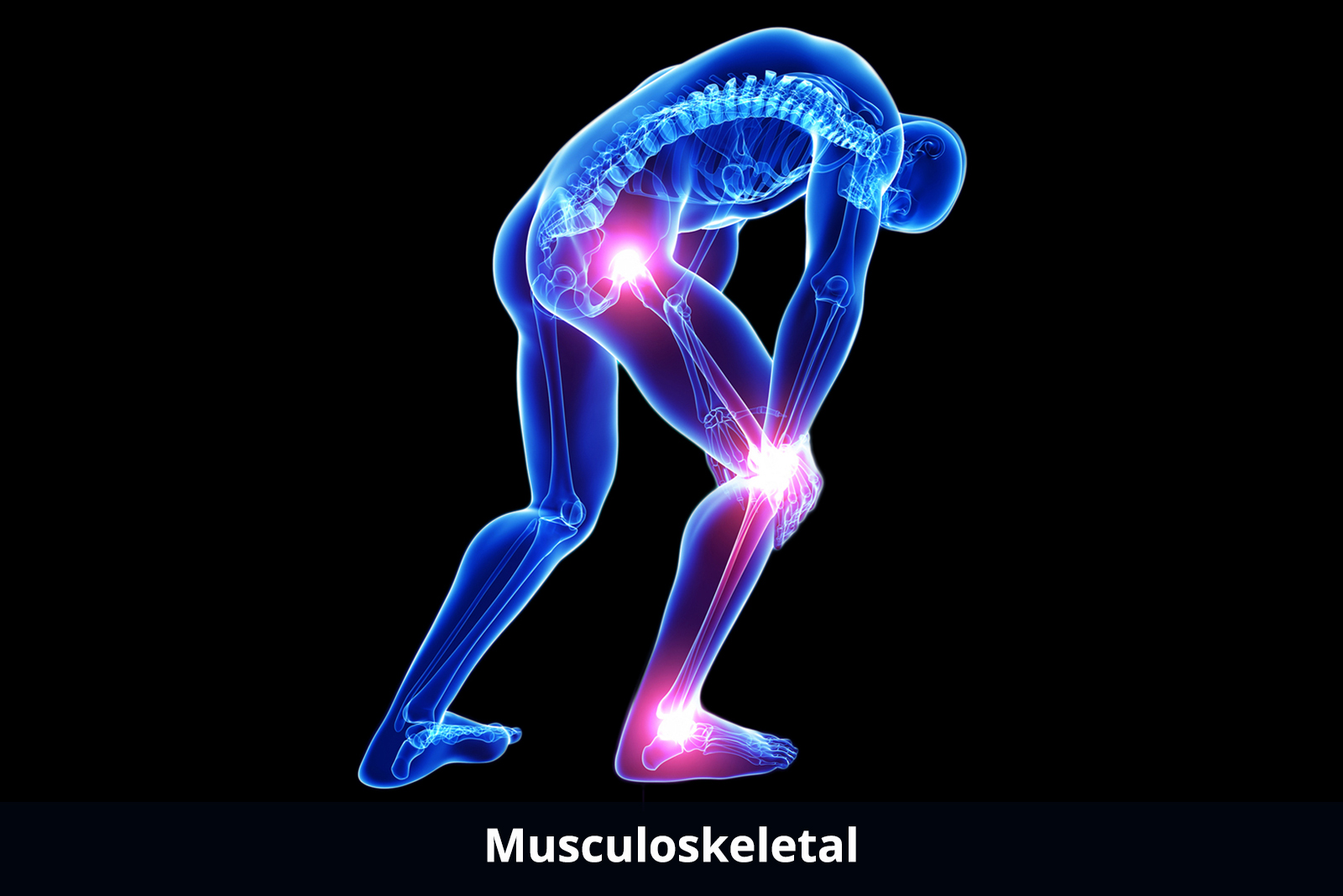 musculoskeletal-about