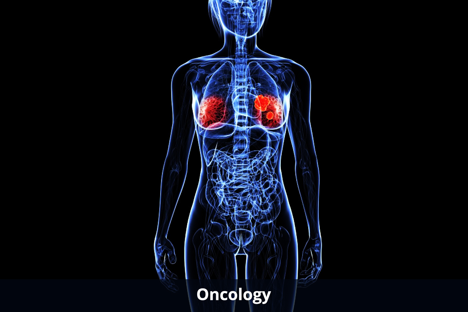 oncology-about
