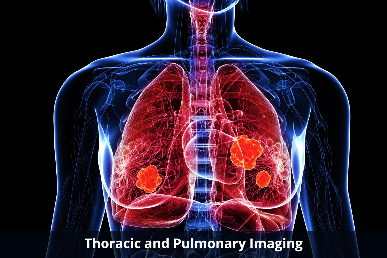 thoracic-and-pulmonary-imaging-about