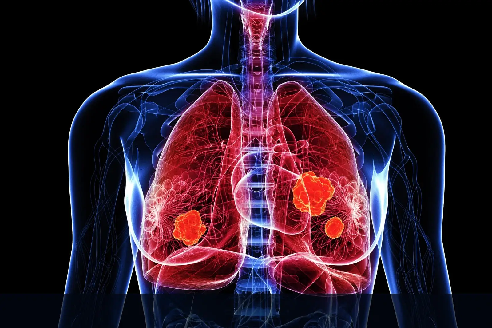 Pulmonary and Thoracic